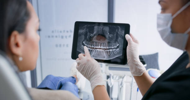 Licensed Wisdom Tooth Removal service in Vacaville, CA - Smile Center Dentistry